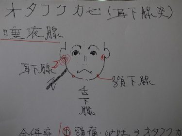 おたふく風邪